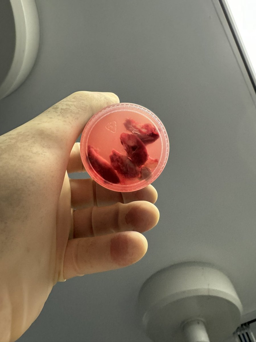 Ali Abedi MD FCCP DAABIP tweet media