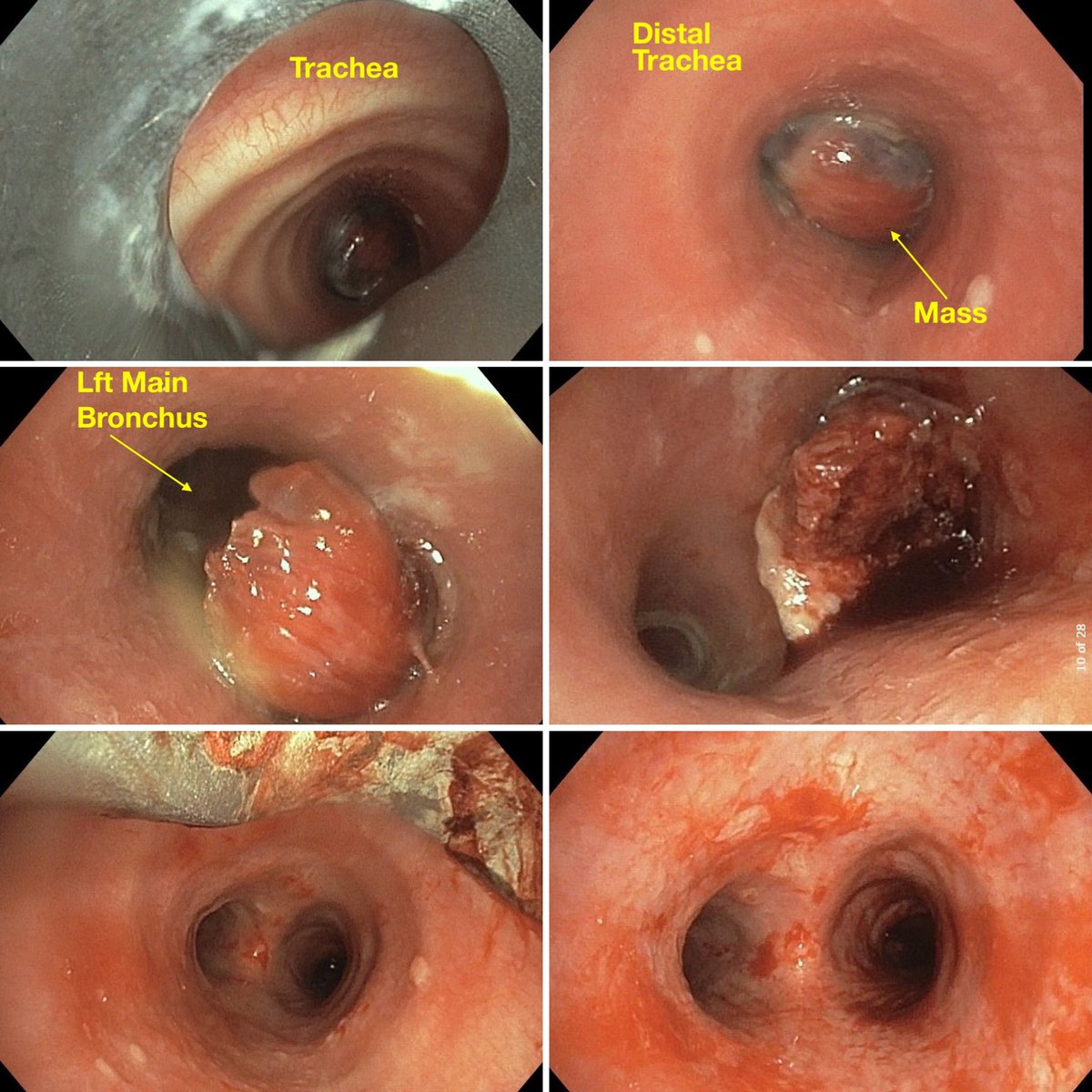 Ali Abedi MD FCCP DAABIP tweet media