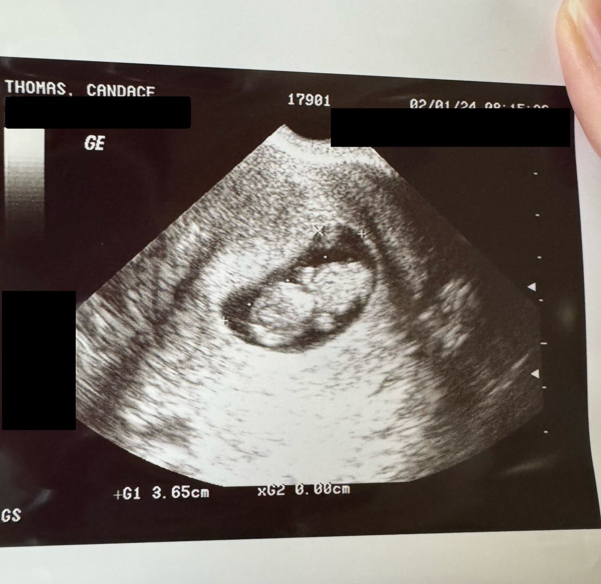 Candace Thakkar tweet media