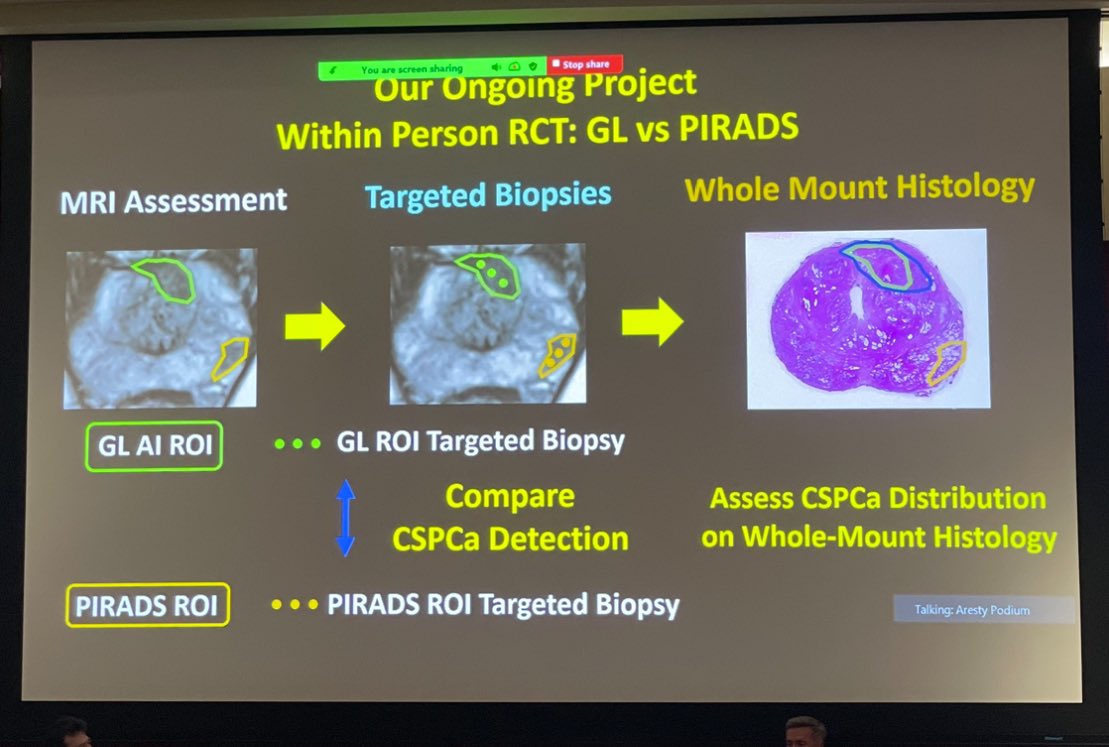 Excellent talk by @ALDCAbreu on #AI in #ProstateCancer diagnosis! 🤖AUC 0.91 for CSPCa detection using combination model! @AIWestMed @USC_Urology @RadiologyUSC @USCRadiomics