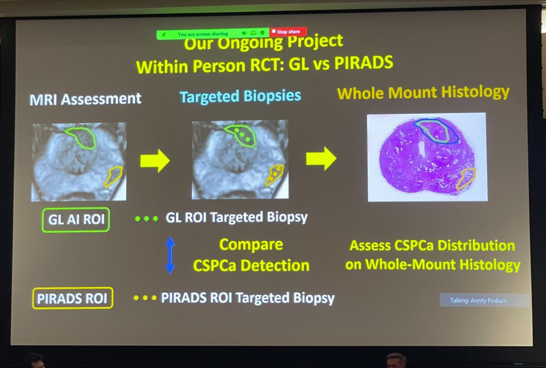 Excellent talk by <a href="/ALDCAbreu/">Dr Andre Abreu</a> on #AI in #ProstateCancer diagnosis!
🤖AUC 0.91 for CSPCa detection using combination model! 
<a href="/AIWestMed/">AIWestMed</a> <a href="/USC_Urology/">USC Urology</a> <a href="/RadiologyUSC/">Radiology of USC</a> <a href="/USCRadiomics/">USC Radiomics Lab</a>