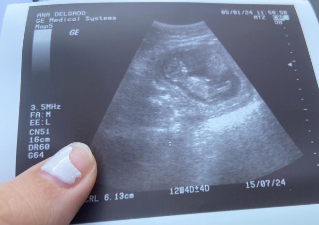 Ana G.💗 tweet media