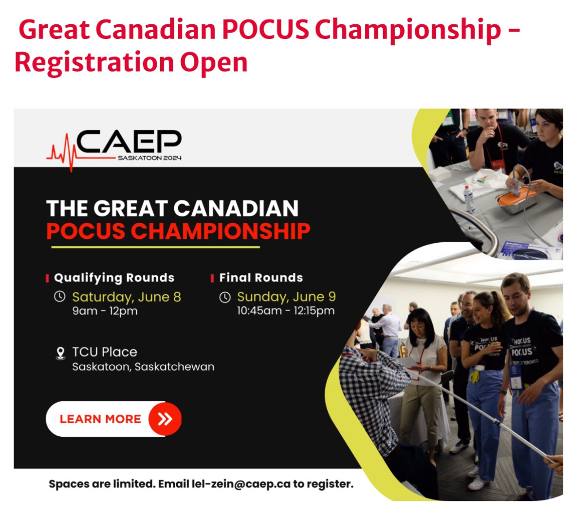 Are you a resident/med student/RN/paramedic coming to @CAEPConference #CAEP24? Registration for the Great Canadian #POCUS Championship is now open! Register at: caepconference.ca/sono-olympiad/ @CAEP_Docs @CAEP_EUC @GillianSheppar9