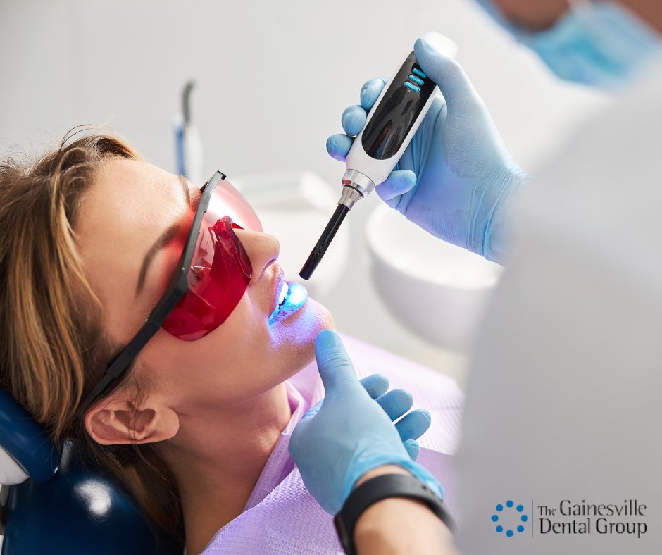 GainesvilleDG's tweet photo. Gainesville Dental Group is committed to helping you achieve optimal oral health through preventive care. Dental sealants are thin coatings applied to the back teeth where bacteria and debris love to hang out. They protect the teeth from decay and can prevent cavities. https://t.co/mI3VrhPydT
