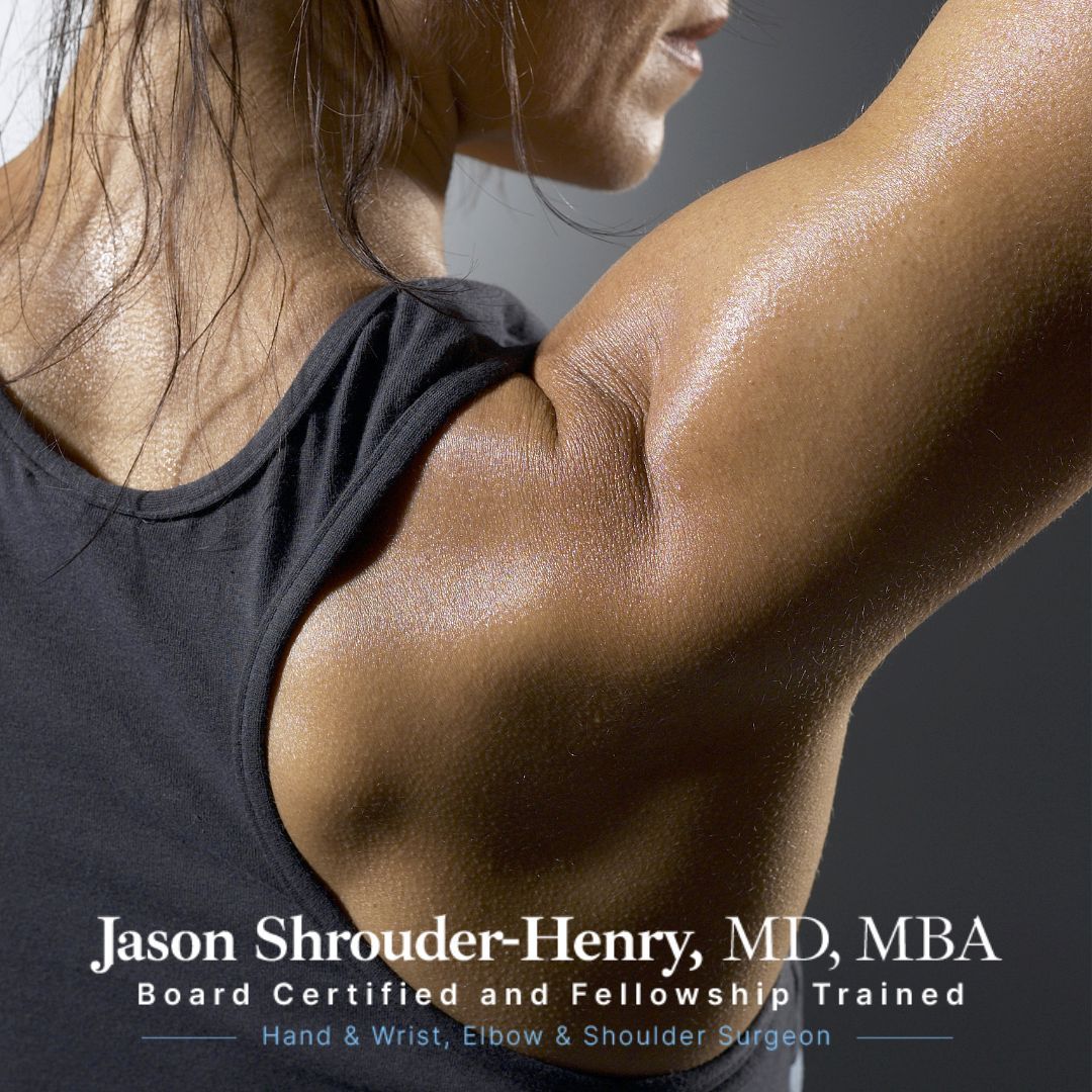 I DO NOT DO SHOULDER ARTHROSCOPY - PLEASE REMOVE THIS POST Step into a new era of shoulder care with Dr. Shrouder-Henry's expertise in #minimallyinvasive shoulder arthroscopy. Experience precision, minimal downtime, and a faster path to recovery. 💪 #DrJasonShrouderHenry