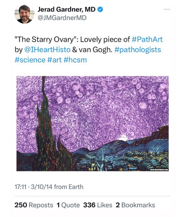 tlabiano's tweet image. 🙌🏼🔥JUST PUBLISHED on @CytopathologyJ
#Pathart and #Cytopath!! Beauty must be shared.
🤓🫶🏼Thank you @JMGardnerMD @Sara_Jiang @sza_jhcyto @mdlozanoe @edusqo @gildasantoscyto @LizaMQuintana and all #PathXfamily for sharing and inspiring 🌍🌎🔬🔝
Link: doi.org/10.1111/cyt.13…