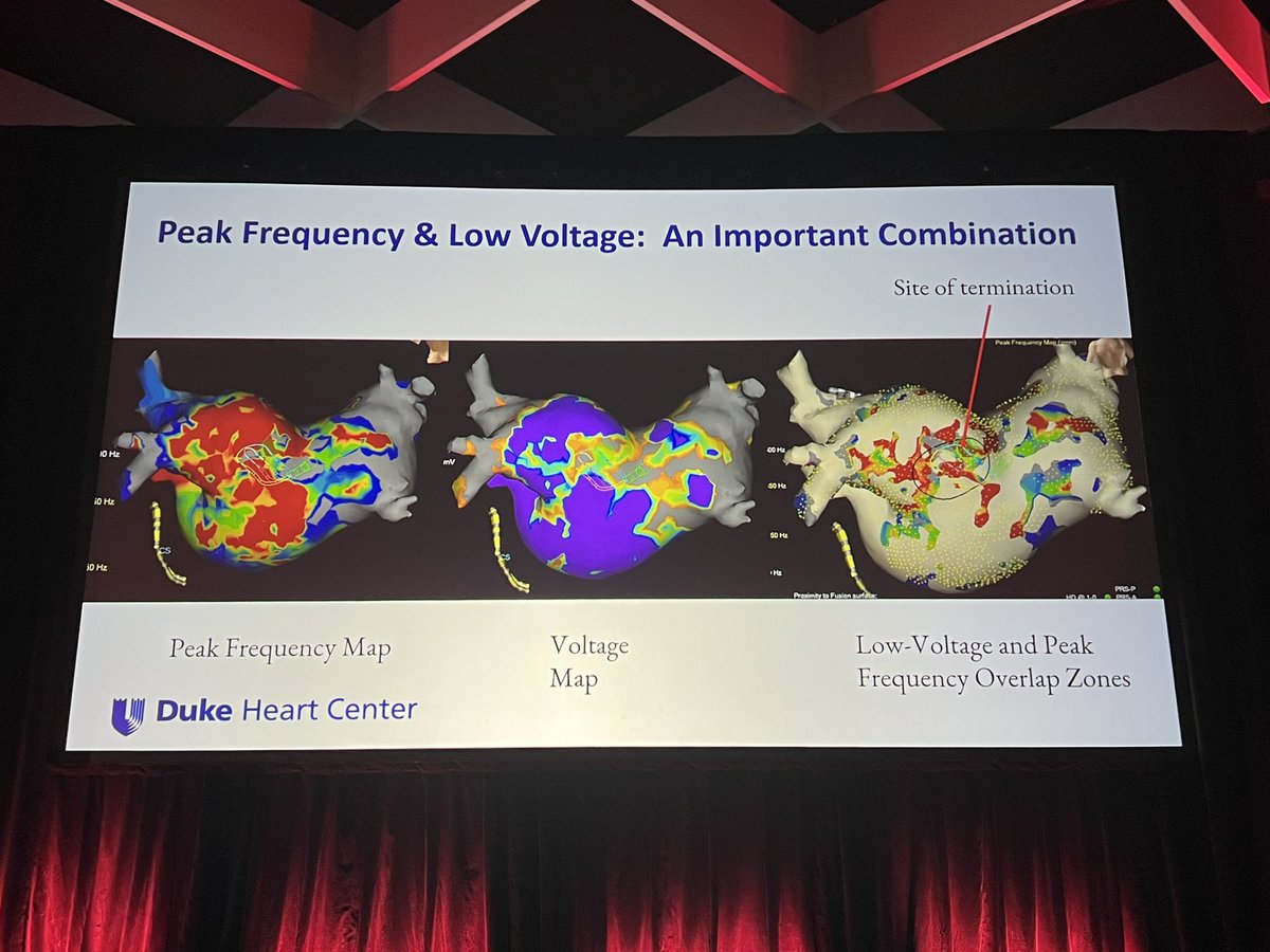 MoussaMansour10's tweet photo. Advances in localizing and defining arrhythmia mechanisms- impact of omnipolar peak frequency mapping - Jonathan Piccini, MD 
#AFsymposium2024 https://t.co/nnvXNTVS1R