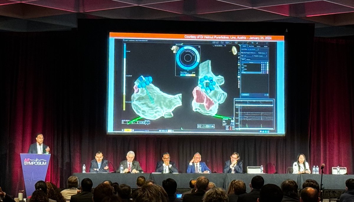 sachinjv's tweet photo. Second generation balloon in basket design - why depth matters, even for local PFA. Thanks @atulverma_md for sharing your insights.

#afsymposium2024 #AbbottProud #EPeeps https://t.co/7IBXdg9AnN