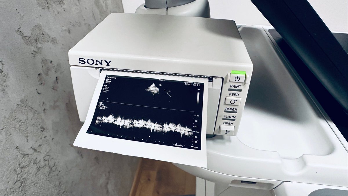 Amigo_Intl's tweet photo. #processing 
Available on May 2024 🙏 

PHILIPS Affinity 70 C ultrasound system
Year of manufacture: 2015
Software version 7
Two cardio transducers: S8-3 (for adult) / S12-4 (for children) https://t.co/54yYYW8b3J