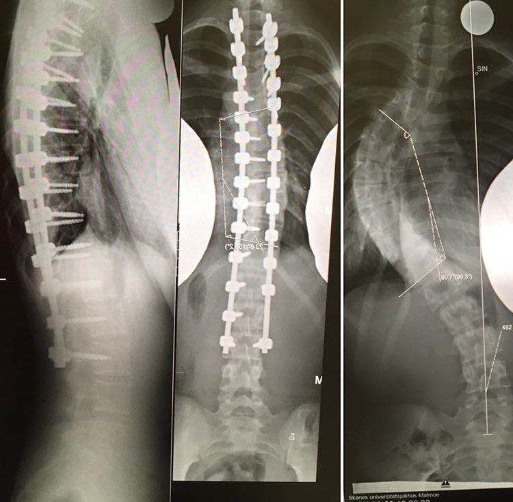 Mathilda tweet media