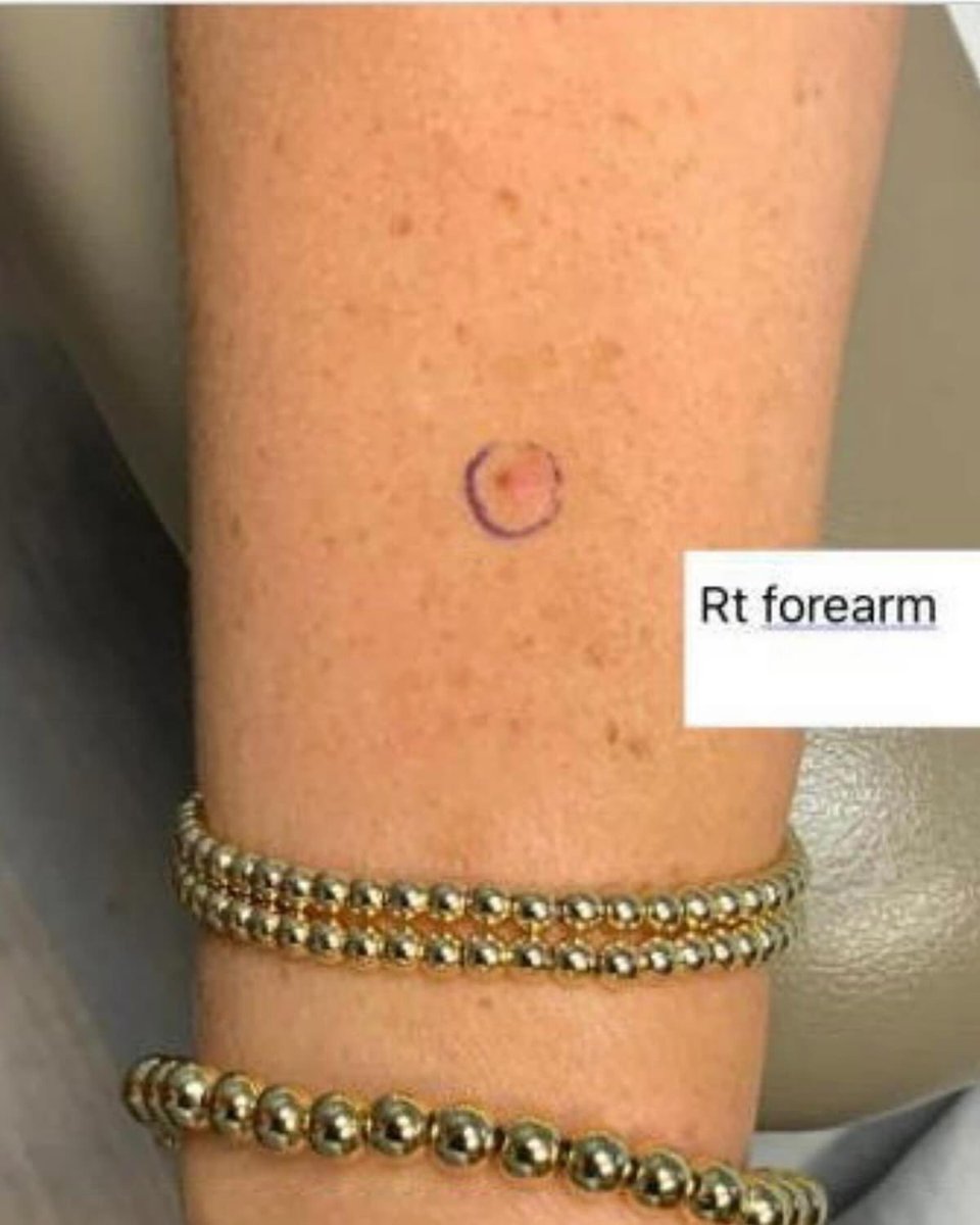 Rodney Childers tweet media