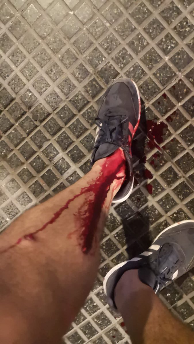 #ahora la policía hirió con bala de goma a nuestro compañero fotógrafo Rodrigo Ruiz. La represión es brutal en estos momentos en las inmediaciones del Congreso y están realizando detenciones ilegales