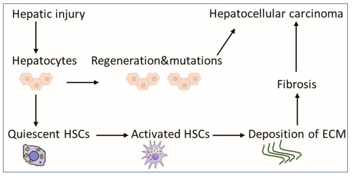 #WorldCancerDay #notablepaper on Topic of Hepatocellular Carcinoma 📚Activated Hepatic Stellate Cells in Hepatocellular Carcinoma: Their Role as a Potential Target for Future Therapies 🔗mdpi.com/1986130 👨‍🔬By Dr. Andriy Trailin et al #Cancers #livercancer
