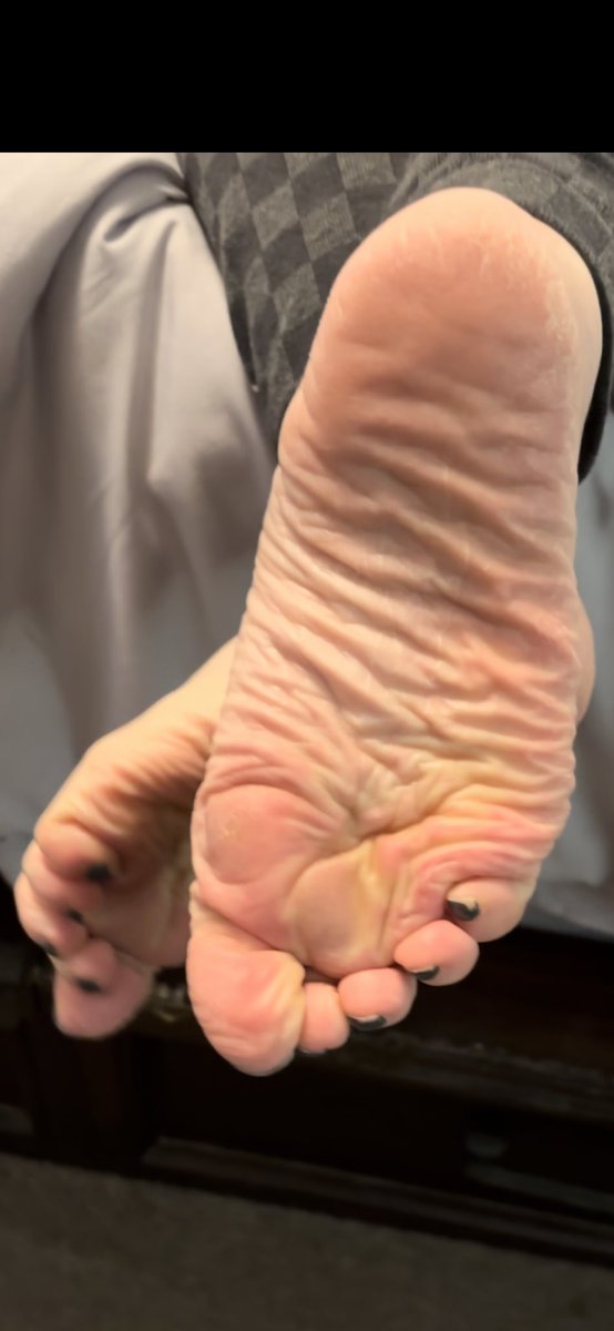 CfootBb's tweet photo. Such a teasing footslut laying around arching and flexing her thick meaty granny feet π#wrinkledsoles #toespreading #roughflatheel like & retweet if you wanna fuc grannies feet πππ¦π¦π¦Ά https://t.co/cgeAri0g8f