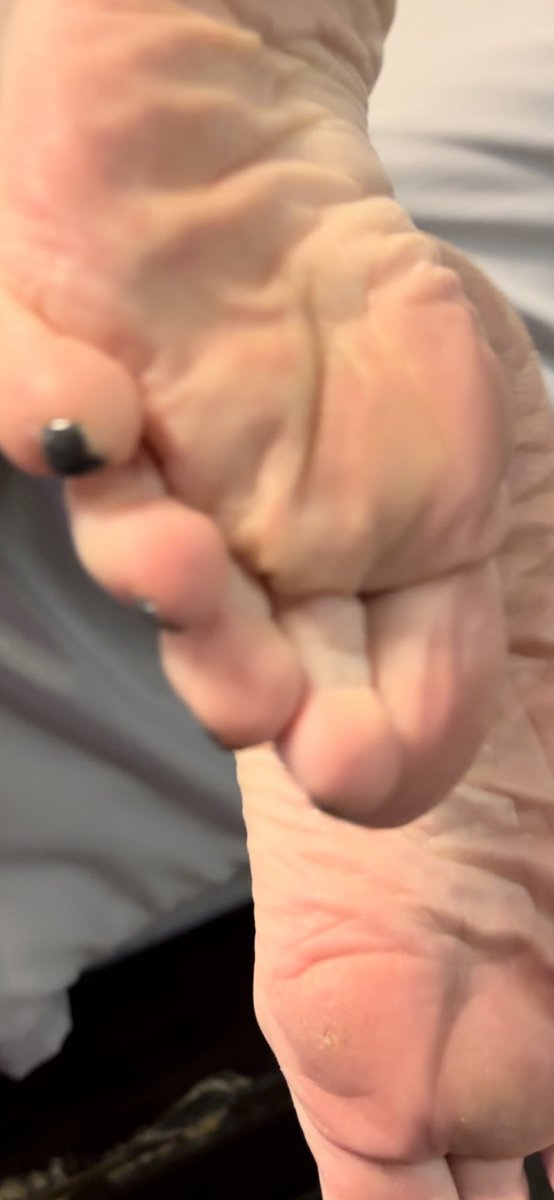 CfootBb's tweet photo. Such a teasing footslut laying around arching and flexing her thick meaty granny feet π#wrinkledsoles #toespreading #roughflatheel like & retweet if you wanna fuc grannies feet πππ¦π¦π¦Ά https://t.co/cgeAri0g8f
