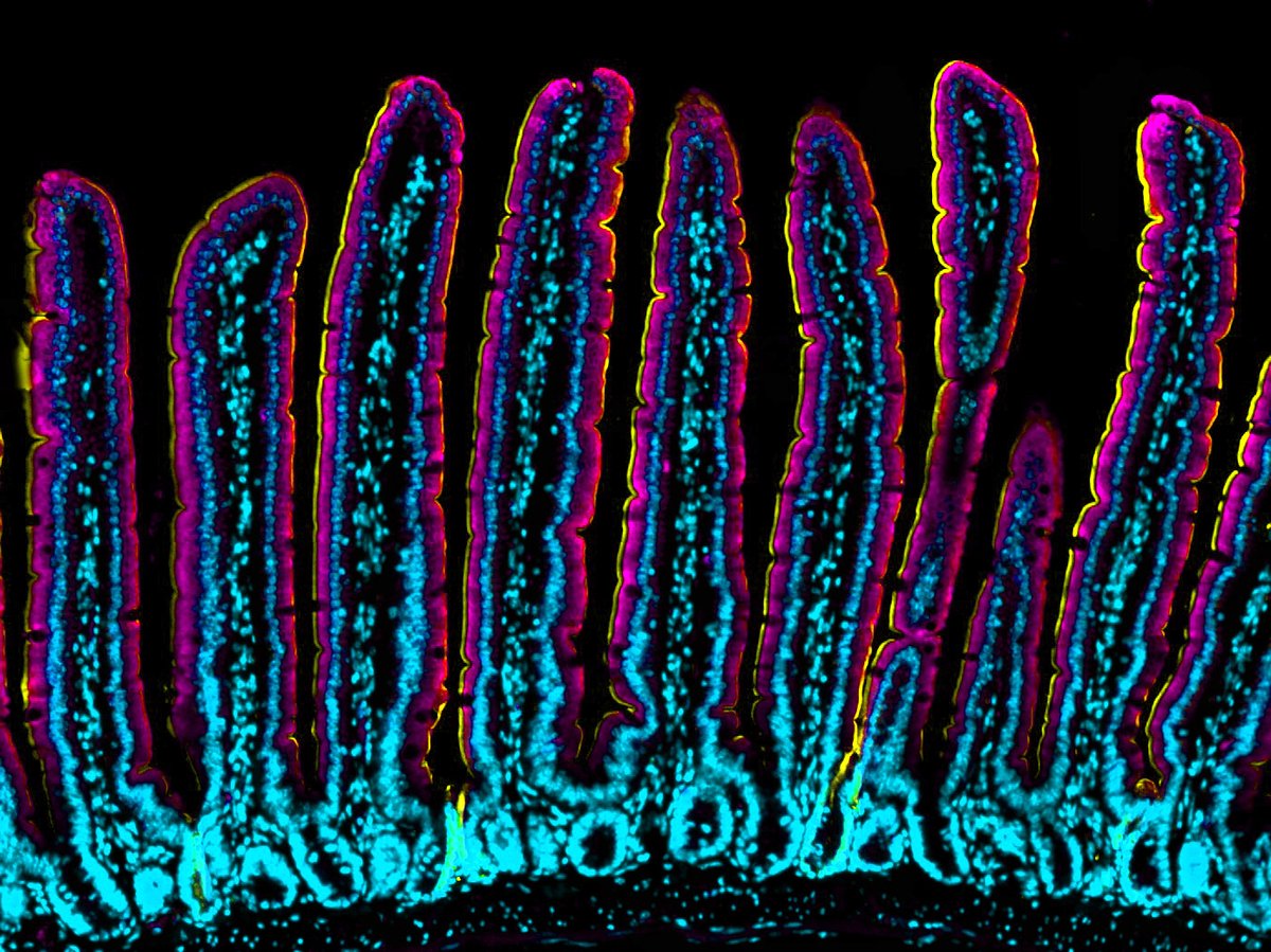 micromindy's tweet photo. Time for some #FluorescenceFriday #fun! Staining for #mucus protein MUC13 in the #intestine. #microscopy #bioart #sciart #mucusmatters #moremucus #mucusmania #FluorescentFriday https://t.co/XKhxiiSz7j