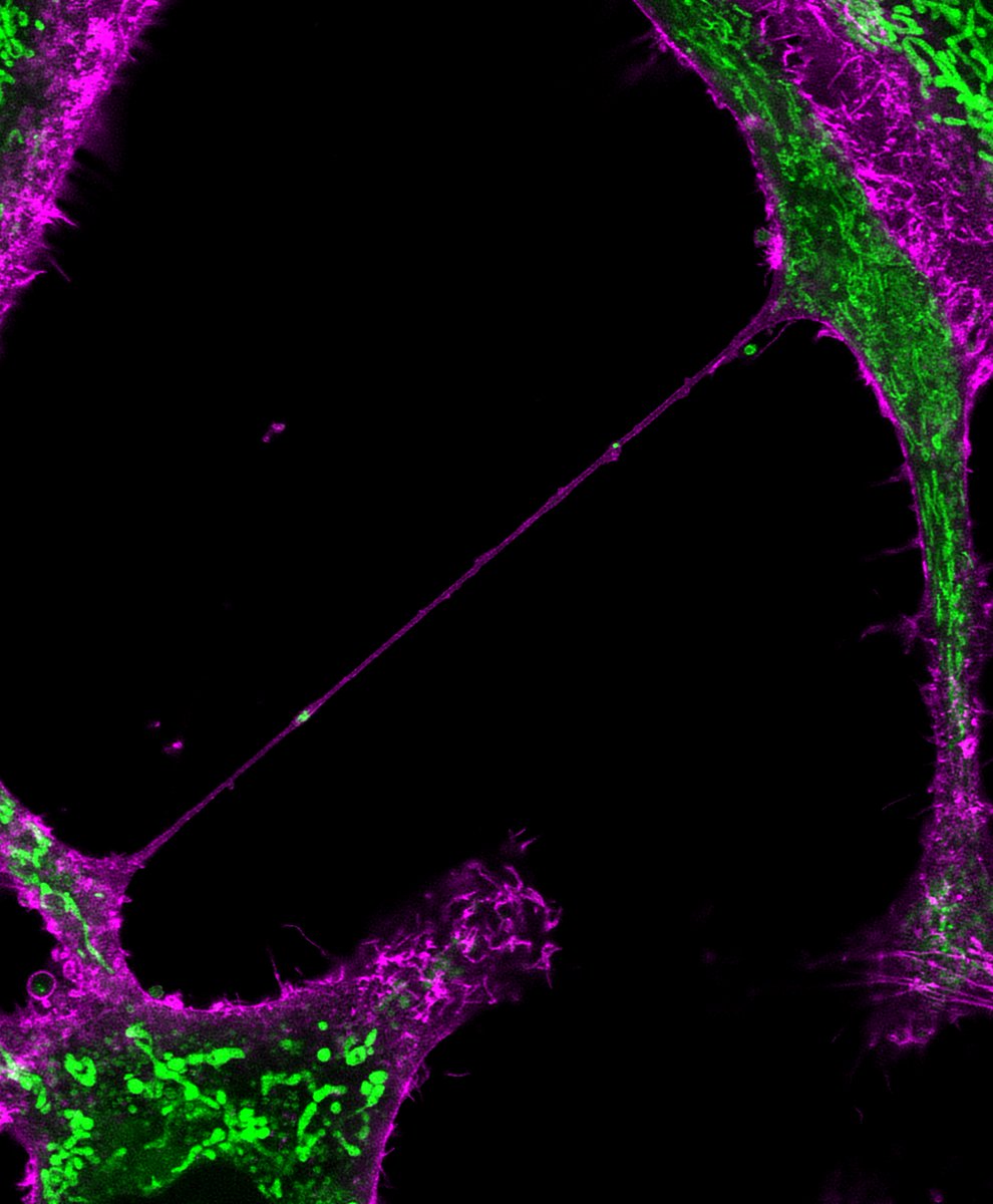 Ian Collinson (@ianofbristol) on Twitter photo Bravo! <a href="/hopeneeds/">Hope Isobel Needs</a> –final instalment of her trilogy of #mitochondria papers <a href="/BristolBiochem/">Bristol Biochemistry</a>
Massive effort also with <a href="/emilyjglover1/">Emily Glover</a> (check her pic!) <a href="/MitoPereira_GC/">Gonçalo C. Pereira</a> Alina Witt, Wolfgang Hübner, <a href="/MarkDodding/">Mark Dodding</a> & Jeremy Henley
Funded by <a href="/wellcometrust/">Wellcome</a> & <a href="/BBSRC/">Biotechnology and Biological Sciences Research</a>
rdcu.be/dxCzS Bravo! <a href="/hopeneeds/">Hope Isobel Needs</a> –final instalment of her trilogy of #mitochondria papers <a href="/BristolBiochem/">Bristol Biochemistry</a>
Massive effort also with <a href="/emilyjglover1/">Emily Glover</a> (check her pic!) <a href="/MitoPereira_GC/">Gonçalo C. Pereira</a> Alina Witt, Wolfgang Hübner, <a href="/MarkDodding/">Mark Dodding</a> & Jeremy Henley
Funded by <a href="/wellcometrust/">Wellcome</a> & <a href="/BBSRC/">Biotechnology and Biological Sciences Research</a>
rdcu.be/dxCzS
