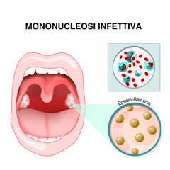 La mononucleosi infettiva è una malattia comune che non va trascurata... meglio informarsi! 👉tinyurl.com/z3dvppr4 #salute #herpes #saliva #mononucleosi