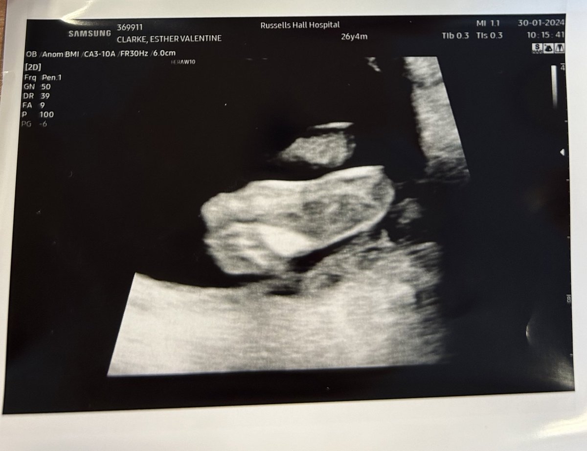 estvalentine's tweet photo. I wake up every morning feeling soooo grateful for the little love of my life that I’m growin 🥹🤰🏼👶🏼👣 https://t.co/OrWMGj9pCe