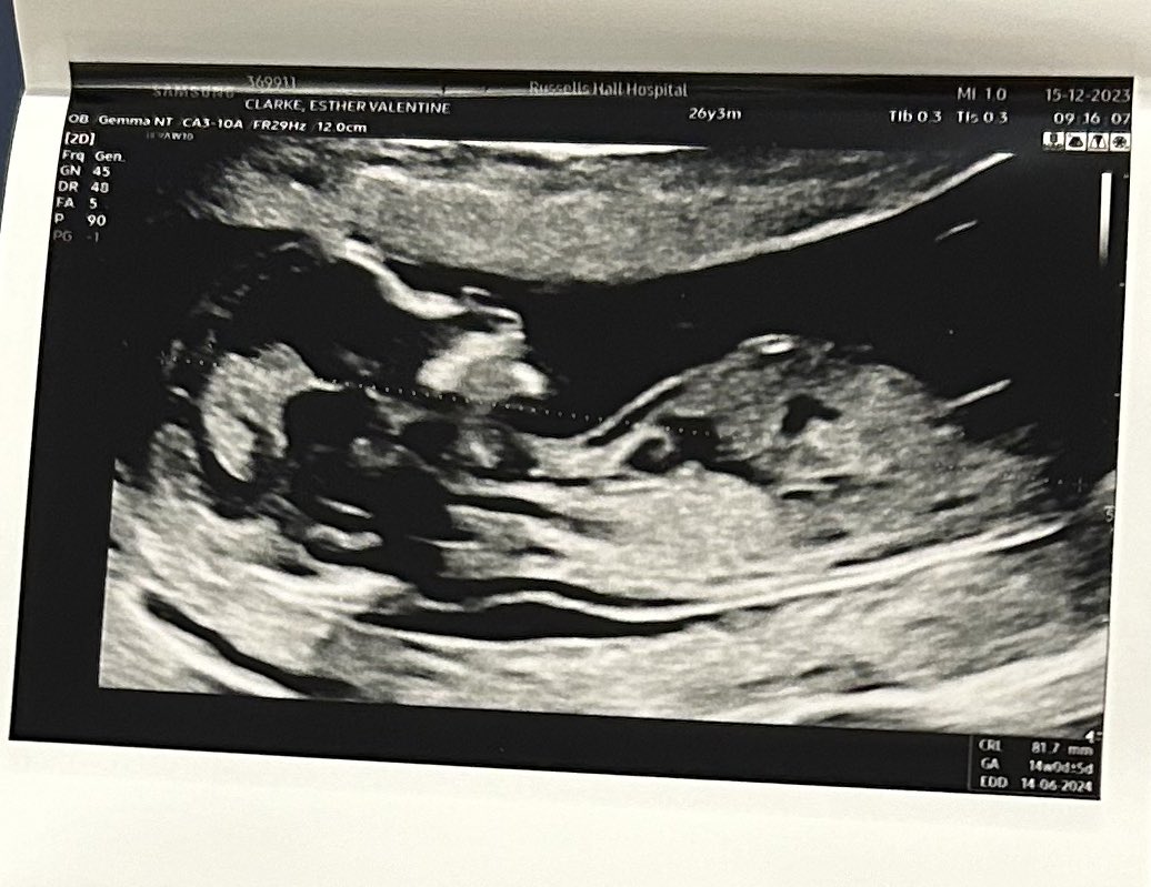estvalentine's tweet photo. I wake up every morning feeling soooo grateful for the little love of my life that I’m growin 🥹🤰🏼👶🏼👣 https://t.co/OrWMGj9pCe