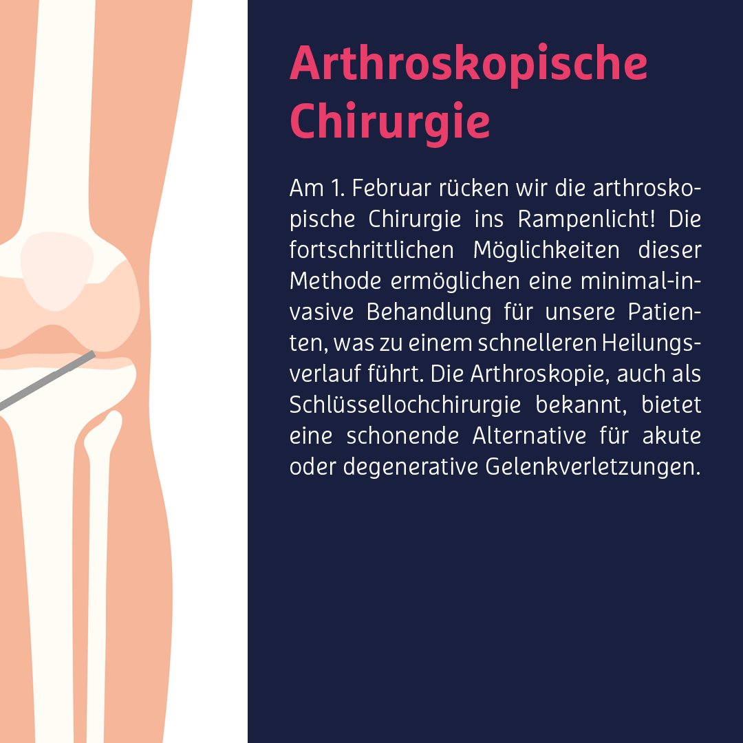 Tag der Arthroskopie! Arthroskopie, auch bekannt als Schlüssellochchirurgie, ermöglicht es uns, bei akuten oder verschleißbedingten Verletzungen der großen Gelenke wie Schulter, Knie und Sprunggelenk präzise und schonend vorzugehen. 
#aga #arthroskopiehilft #tagderarthroskopie