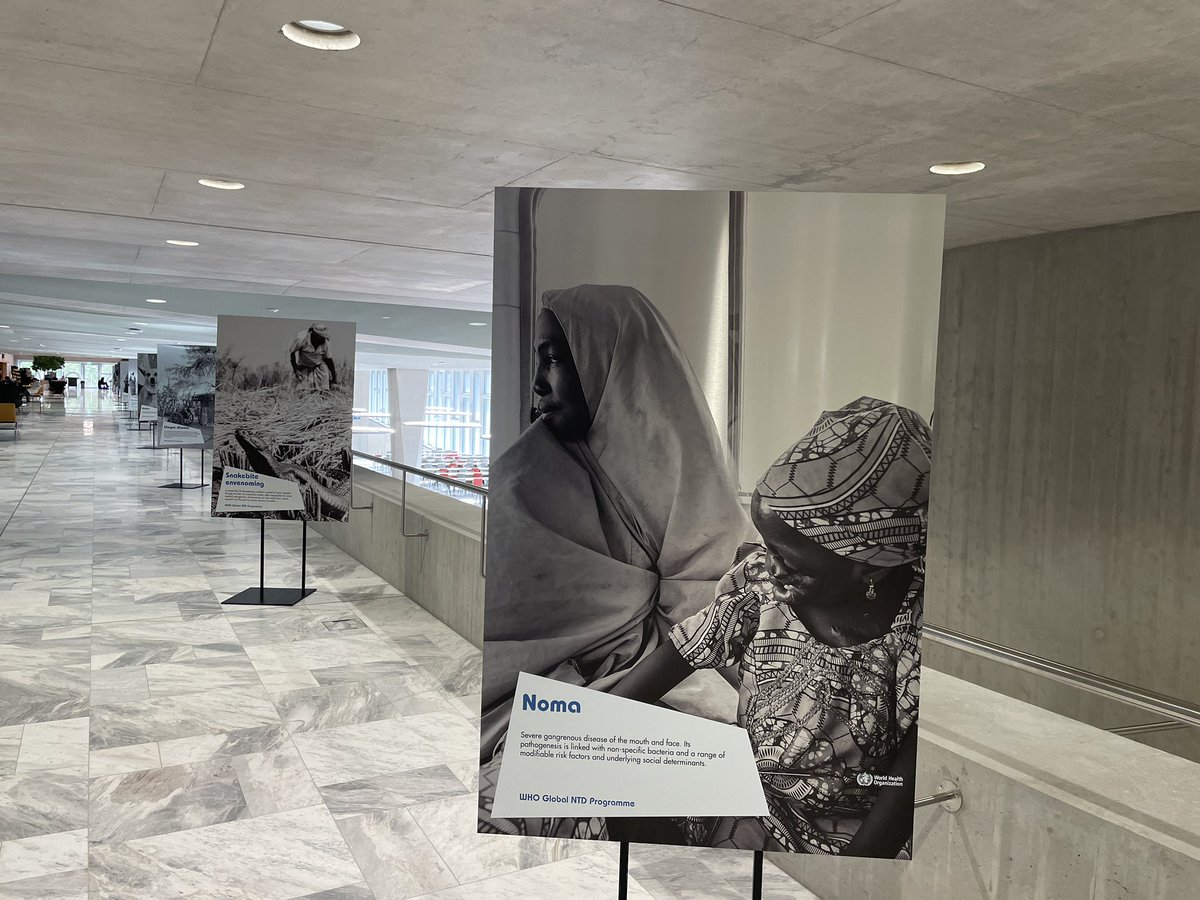 NicoleRendell's tweet photo. Rounding out #NTD “week” with two faces of #Noma - one leading the series of boards at @WHO (see photo) and the other tucked into a feature story here https://t.co/4dZ0V3WmSZ 
Thanks to @FidelStrub for sharing your story 🙏
#NCD #oralhealth https://t.co/Upuh4QPay0
