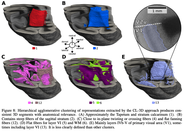 BigBrain (@bigbrainproject) on Twitter photo New paper out by Alexander Oberstraß on Self-Supervised Representation Learning for Nerve Fiber Distribution Patterns in 3D-PLI 👉arxiv.org/abs/2401.17207 <a href="/ChristianSchif8/">Christian Schiffer</a> <a href="/dickscheid/">Timo Dickscheid</a> <a href="/MarkusAxer/">Markus Axer</a> <a href="/receptorworld/">Nicola Palomero</a> <a href="/NiuMeiqi/">Meiqi Niu</a> @HelmholtzAI <a href="/fz_juelich/">Forschungszentrum Jülich | @fzj@social.fz-juelich</a> New paper out by Alexander Oberstraß on Self-Supervised Representation Learning for Nerve Fiber Distribution Patterns in 3D-PLI 👉arxiv.org/abs/2401.17207 <a href="/ChristianSchif8/">Christian Schiffer</a> <a href="/dickscheid/">Timo Dickscheid</a> <a href="/MarkusAxer/">Markus Axer</a> <a href="/receptorworld/">Nicola Palomero</a> <a href="/NiuMeiqi/">Meiqi Niu</a> @HelmholtzAI <a href="/fz_juelich/">Forschungszentrum Jülich | @fzj@social.fz-juelich</a>