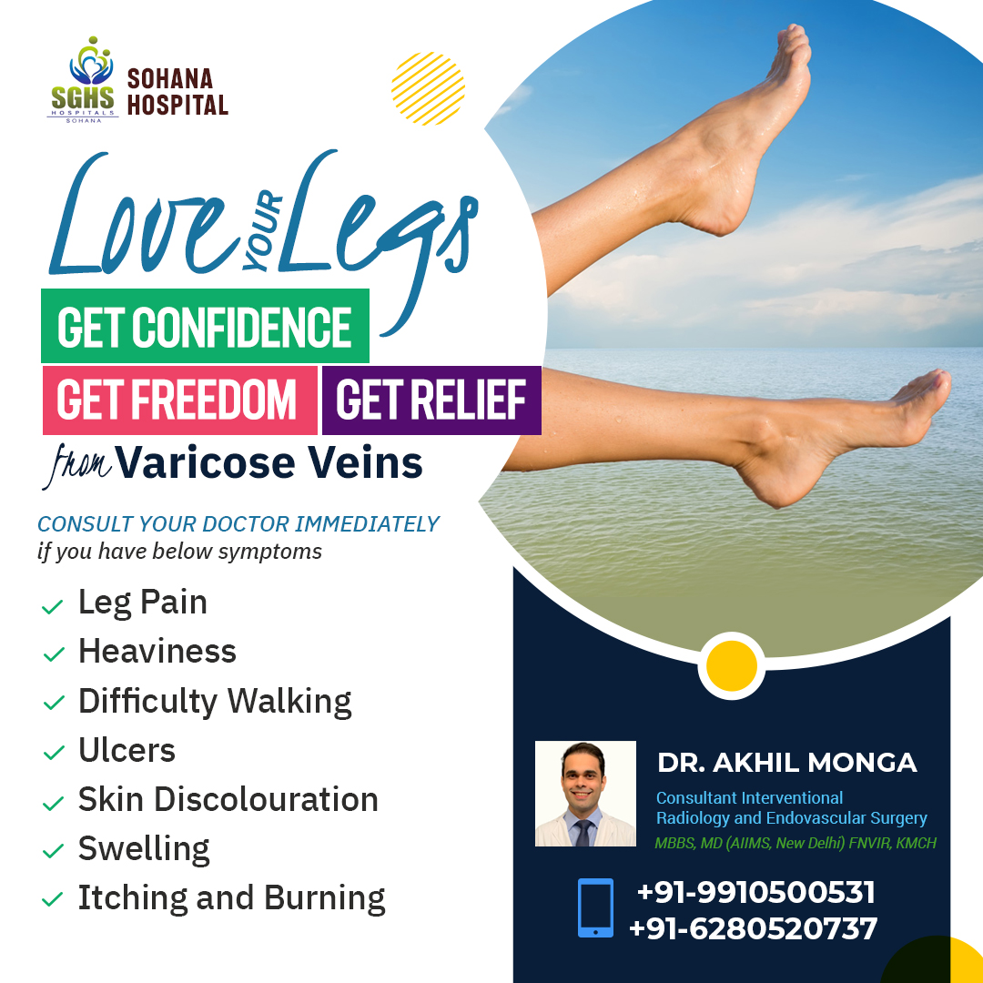Varicose veins, often in the legs, cause symptoms. Advanced technology offers simple and effective treatment methods for this twisted and enlarged vein condition. bit.ly/3X0x64x #Varicoseveins #legpain #legswelling #ulcers