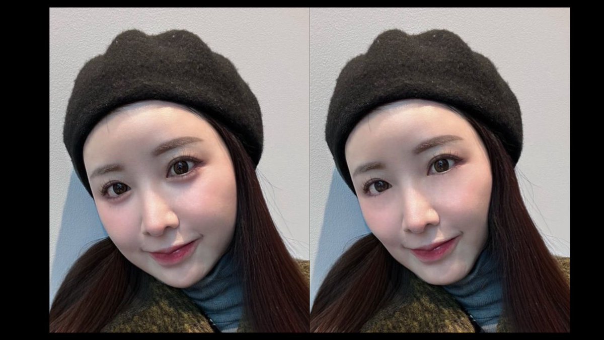 chika_biyouhihu's tweet photo. 中顔面短く見せたかったら！！涙袋の有無、頬の張り感､こめかみ〜額の丸さが中顔面の見え方に大きく影響する！！
という分かりやすい比較画像を作ってみました。

顔の長さや大きさは変わらないのに､面長に見える。。

涙袋の下の影感は中々とれないなと思っていたけど､いざ無くしてみると､不自然な感じもするから､
無くしきれない陰影ってすごく大事かも？と思いますね。

ほうれい線、とか、くまとかね。