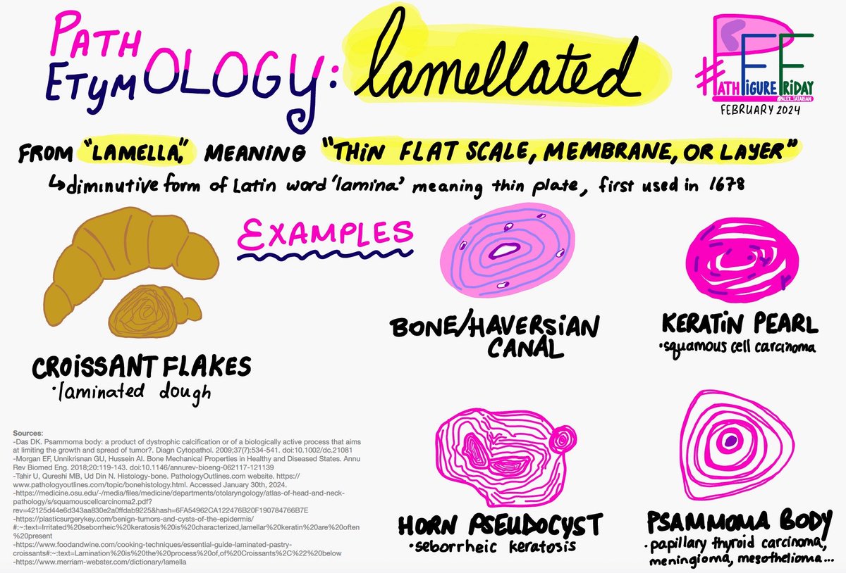 alex_tatarian's tweet photo. It’s #PathFigureFriday! 🥐 Here I share diagrams for concepts I’m learning. Please add any comments, corrections, or creations of your own!

#PathTwitter #PathX #MedX 
#laminated #lamellated #lamina
#baking #MedTwitter #etymology 

⬇️More:
https://t.co/Xme45LB3Wd https://t.co/eZILgxoSDC