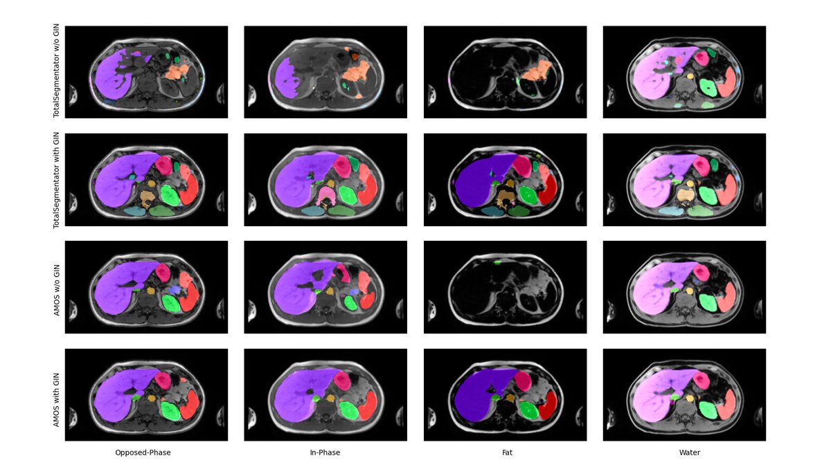 FraunhoferMEVIS's tweet image. Towards #TotalSegmentator for #MRI data leveraging GIN #DataAugmentation: Find out more in our talk at #SPIEMedicalImaging in #SanDiego. s.fhg.de/2L9
#ImageSegmentation