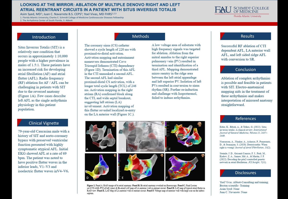 vivasfhrs's tweet photo. My favorite Electrophysiology conference of the year. AF symposium! Proud of cardiology fellow Asym Syed and mappers working together @JuanBurnTerm presenting an interesting case. The Arrhythmia  Center of South Florida. #AblateAF https://t.co/vhLE2sv7Ij