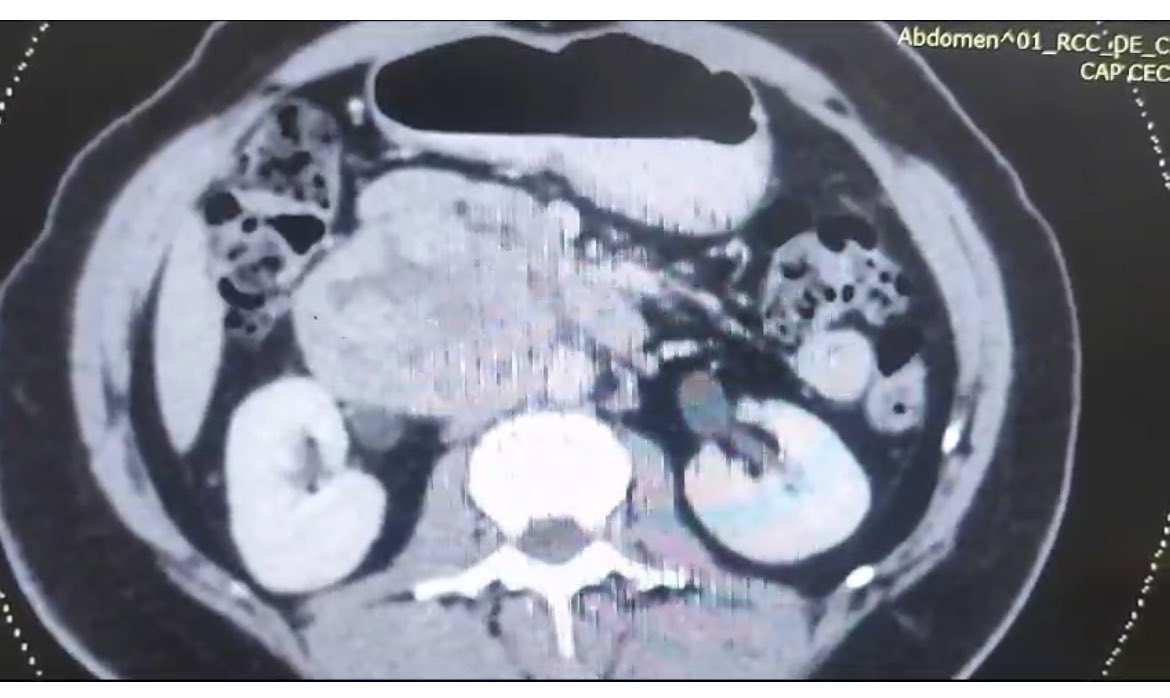 Dr Shivanesan Pitchai tweet media