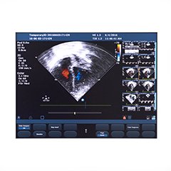 L'ecocolordoppler utilizza gli ultrasuoni, che non sono dannosi per l'uomo, ed è quindi possibile usarlo per accertare e monitorare molte malattie cardiovascolari 👉tinyurl.com/yc5tzz3f #ecocolordoppler #AnalisiCliniche