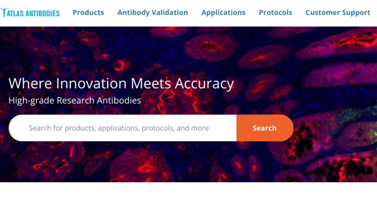 Our website offers a seamless experience for custom or bulk orders of primary antibodies and top-notch prest antigens: 👉ow.ly/3S7b50Qx6kA #atlasantibodies #antibodies #PrecisAMonoclonals #TripleAPolyclonals #antigens #prestatigens #neuroscience #cancer #cellbiology