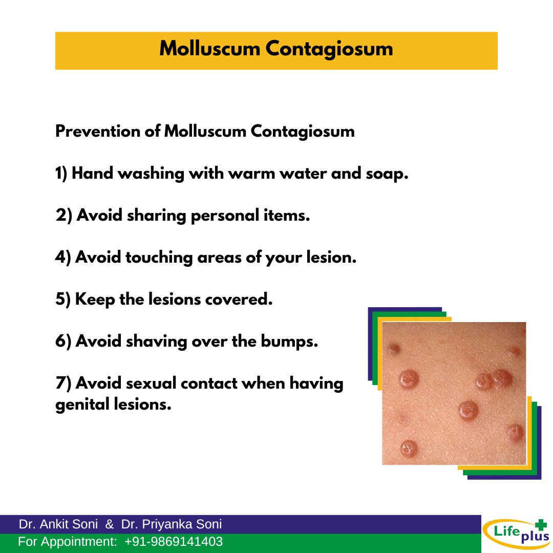 ahsoni1986's tweet photo. Prevention of Molluscum Contagiosum

Details in image below

 #lifeplushomoeopathyclinic #homeopathy #molluscumtreatment #molluscum #molluscumcontagiosum #eruption https://t.co/vHrEkCx5J1