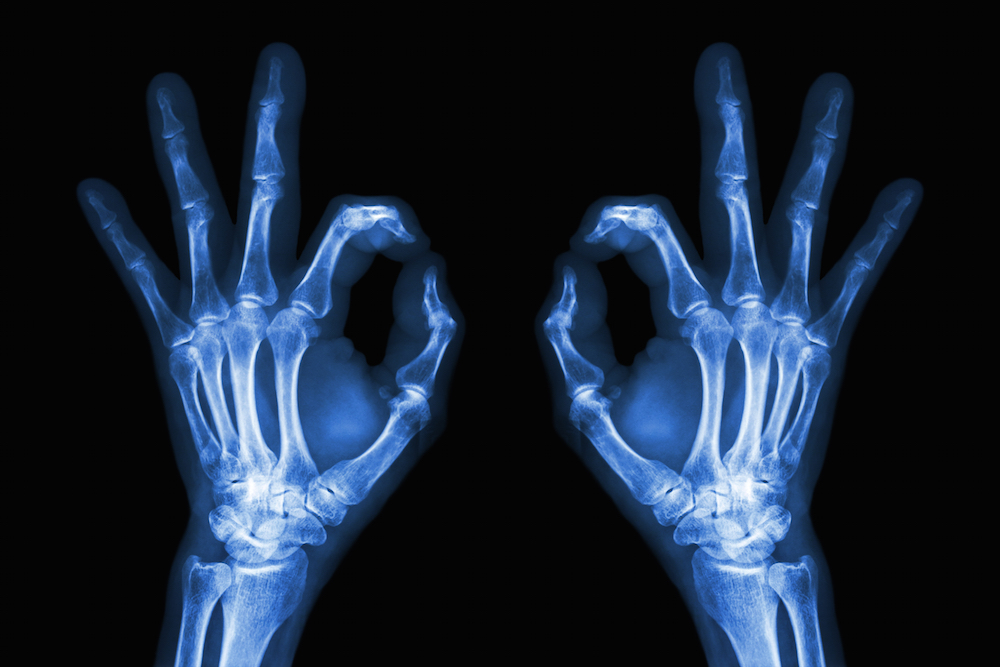 Well done to our amazing radiology team for this lovely patient feedback: "I was very apprehensive about going to hospital but was simply thrilled by the lovely manner in which the team made me feel at ease and also valued and supported."
#PatientFeedback #Radiography