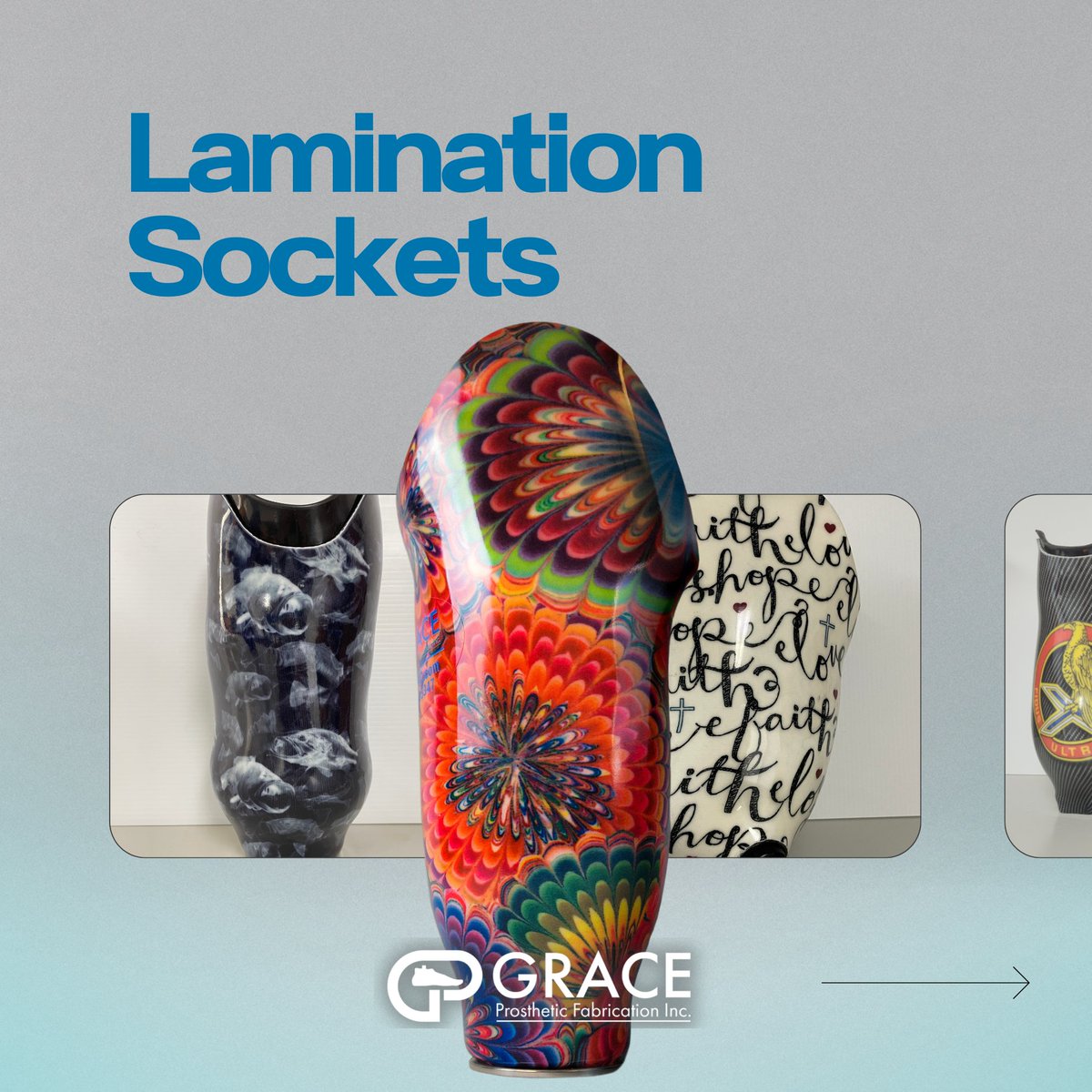 gpfinc's tweet photo. Don't let your prosthetic stop you from leading a vibrant life. Our custom lamination process lets your personality shine through!
#lamination #prosthetic #prosthetictech #prostheticinnovations #prosthetistorthotist #graceprostheticfabrication #graceprosthetics #graceplace https://t.co/jUHCc0w9On