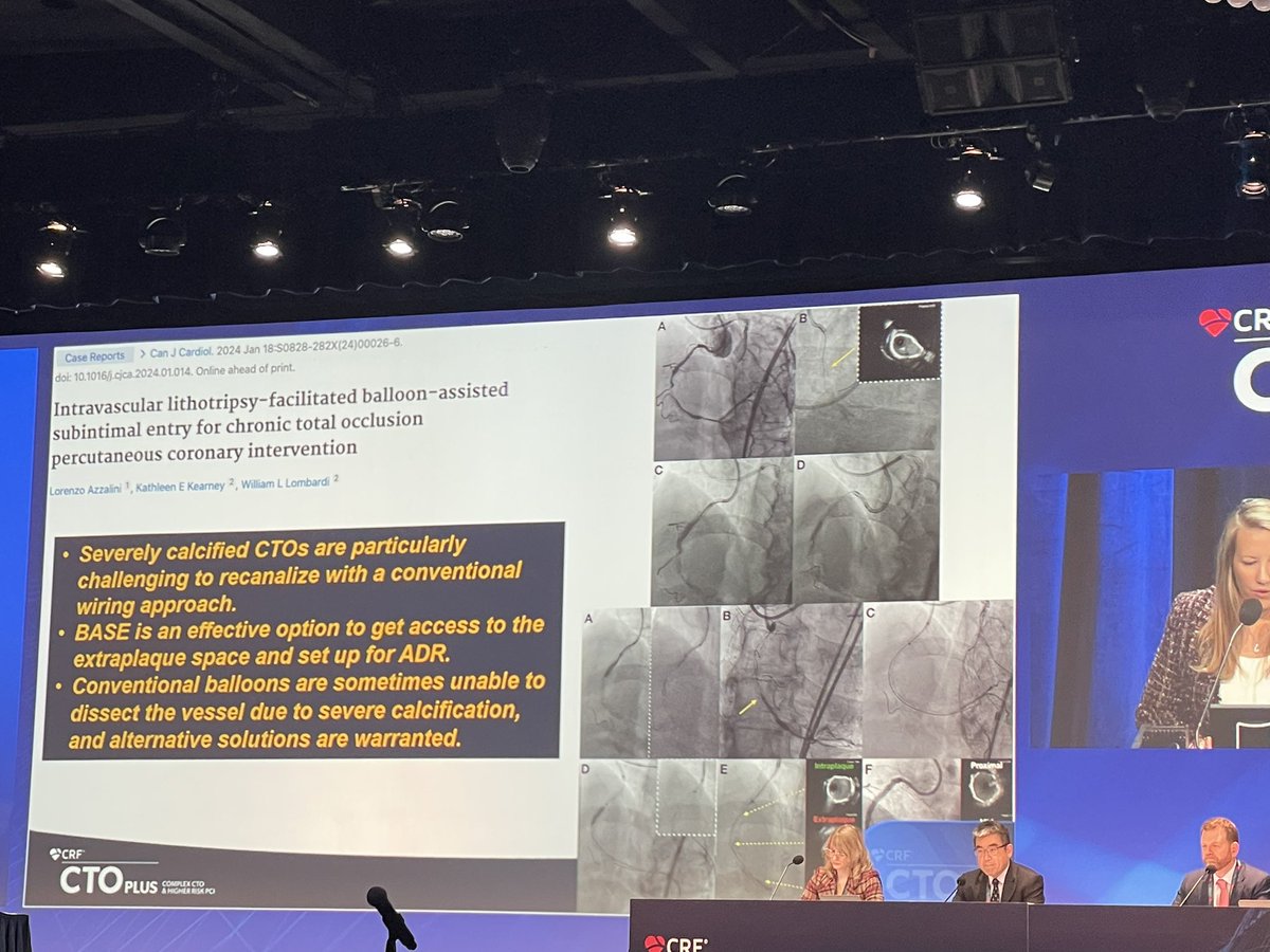 Matheen Khuddus (@matheenkhuddus) on Twitter photo #CTO2024 getting kicked off with an impressive review of what happened this year in CTO PCI by <a href="/RhianEDavies1/">Rhian E. Davies DO MS</a> #CTO2024 getting kicked off with an impressive review of what happened this year in CTO PCI by <a href="/RhianEDavies1/">Rhian E. Davies DO MS</a>