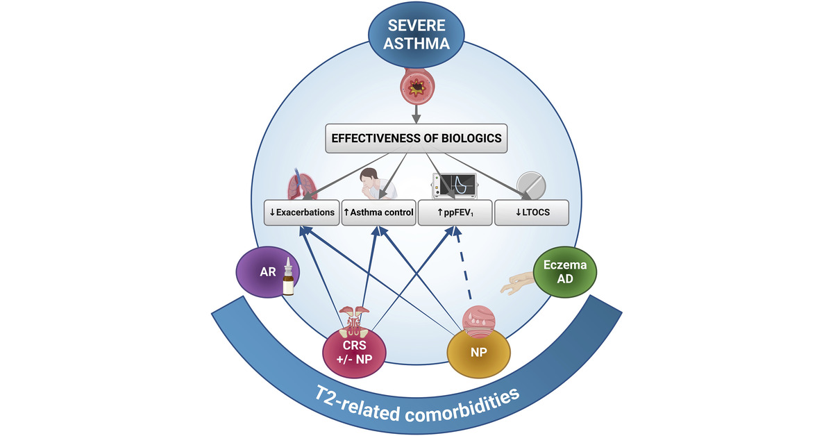Do Comorbidities Influence the Response to Biologics in Severe Asthma?

🔓 Open Access
🔗 bit.ly/3vYazfD