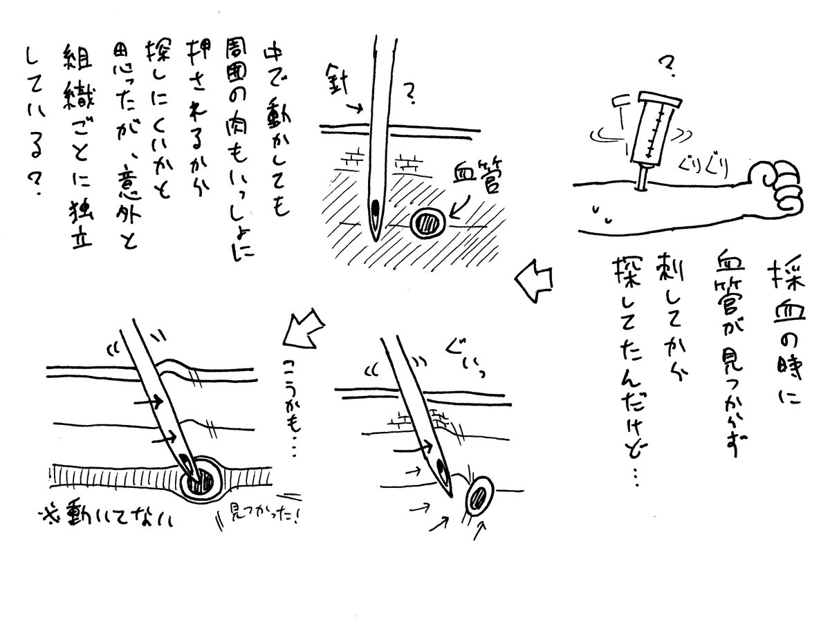 2/2
今年も血管が見つからず最後まで居残りした 