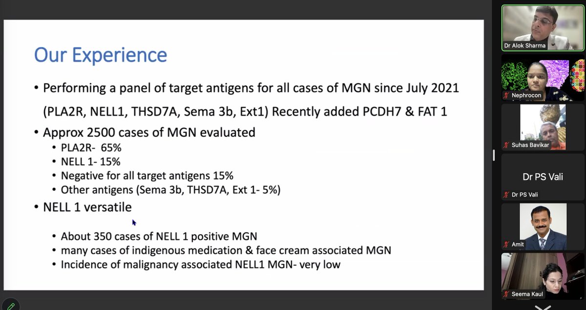 Nephrocon (@nephrocon) on Twitter photo In-depth analysis of Antigens of Membranous nephropathy trending in India by <a href="/draalok/">Alok Sharma</a> . Very informative & useful for #nephrologists.
Live on youtube.com/@NephroCon?si=… In-depth analysis of Antigens of Membranous nephropathy trending in India by <a href="/draalok/">Alok Sharma</a> . Very informative & useful for #nephrologists.
Live on youtube.com/@NephroCon?si=…