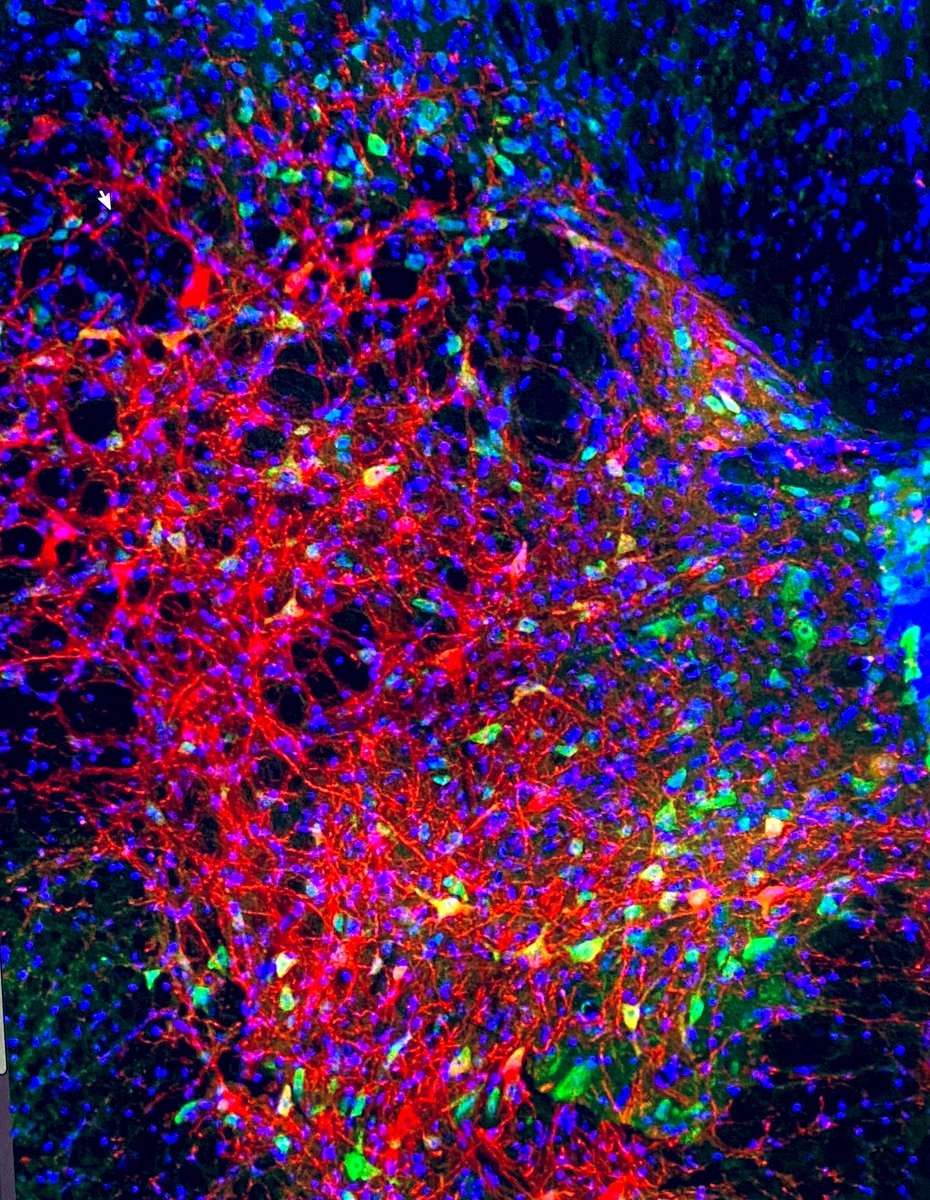 KajanaSatkune's tweet image. Happy #flourescentfriday #spinalcord