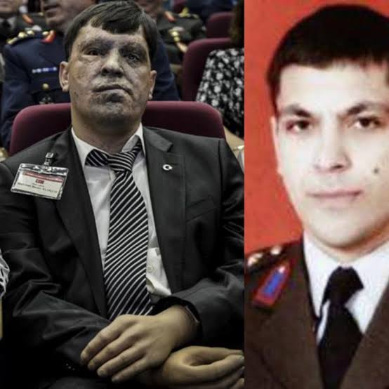 GAZİLER ONURUMUZDUR!🇹🇷