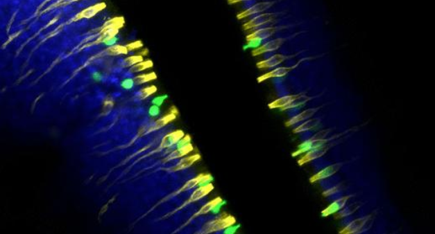 LabWaggoner's tweet photo. TRPM5+ microvillous cells in the olfactory neuroepithelium are tuft cells that regulate olfactory stem cell proliferation @BankovaLora @SciImmunology @AlexanderPerni et al
https://t.co/WjBuHvLzwq https://t.co/WQfqRznGpB