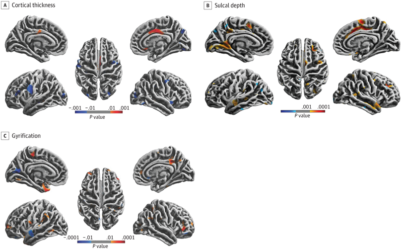 SaulNutri's tweet photo. 🧠¿COMO AFECTA JUGAR AL FÚTBOL AL CEREBRO ADOLESCENTE?

⚽Golpear el balón repetidamente con la cabeza puede provocar alteraciones. En este caso tenemos un ensayo con 275 participantes bastante interesante.

Dentro hilo🧵👇 https://t.co/UQHOq3H2Ge