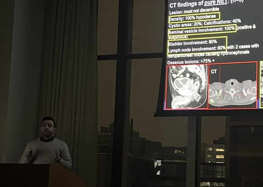 Northwestern Radiology (@nuradiology) on Twitter photo Congratulations to Radiology Research Fellow Muhamad Serhal for his Steven Pinsky Resident Research Award from the Chicago Radiological Society! Muhamad submitted in the Body/MSK category under the mentorship of Dr. Anugayathri Jawahar. <a href="/ChiRadSoc/">Chicago Rad Society</a> <a href="/SerhalMuhamad/">Muhamad Serhal, MD</a> Congratulations to Radiology Research Fellow Muhamad Serhal for his Steven Pinsky Resident Research Award from the Chicago Radiological Society! Muhamad submitted in the Body/MSK category under the mentorship of Dr. Anugayathri Jawahar. <a href="/ChiRadSoc/">Chicago Rad Society</a> <a href="/SerhalMuhamad/">Muhamad Serhal, MD</a>