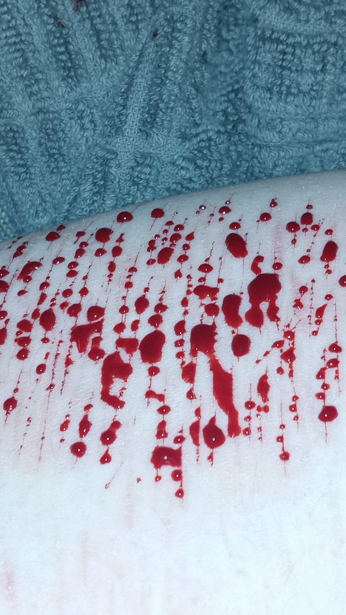 yukilovesh's tweet photo. a shesh i did last night 
kinda wished i went deeper :( 
#988twt https://t.co/RCwYjDQpbk