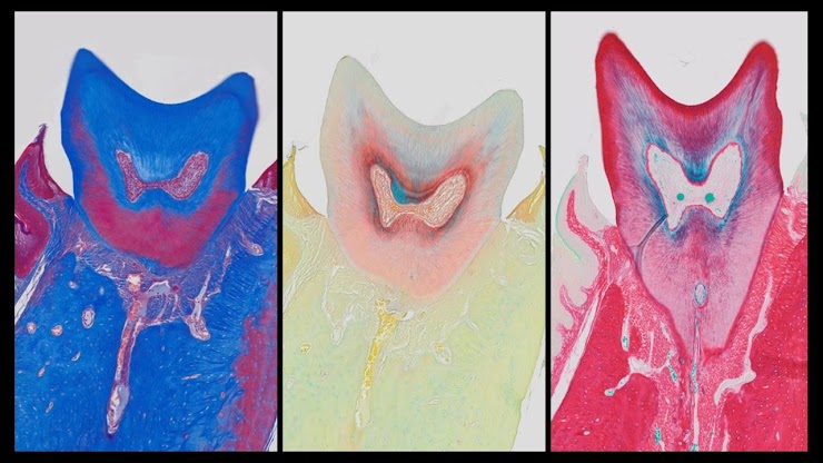 Hani Awad ❄️ (@awad_lab) on Twitter photo <a href="/ORSsociety/">Orthopaedic Research Society</a> Nation, vote for your favorite Art in Science Images, which I am sure you will agree has to be the The Wrestling Molar Brothers: Hypno, Pastel and Slurpy
docs.google.com/forms/d/e/1FAI… <a href="/ORSsociety/">Orthopaedic Research Society</a> Nation, vote for your favorite Art in Science Images, which I am sure you will agree has to be the The Wrestling Molar Brothers: Hypno, Pastel and Slurpy
docs.google.com/forms/d/e/1FAI…