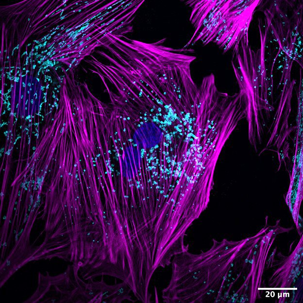 LeighWicki's tweet photo. #FluorescenceFriday - #swaynelab PhD candidate @nicoleyorkova (co-supervised by Dr. Laura Arbour) is exploring how heart muscle cells develop. A peek into the work: components of cellular structure (actin; magenta) and energy generation (mitochondria; cyan).
@dr_swayne https://t.co/fOxKQnmP3K